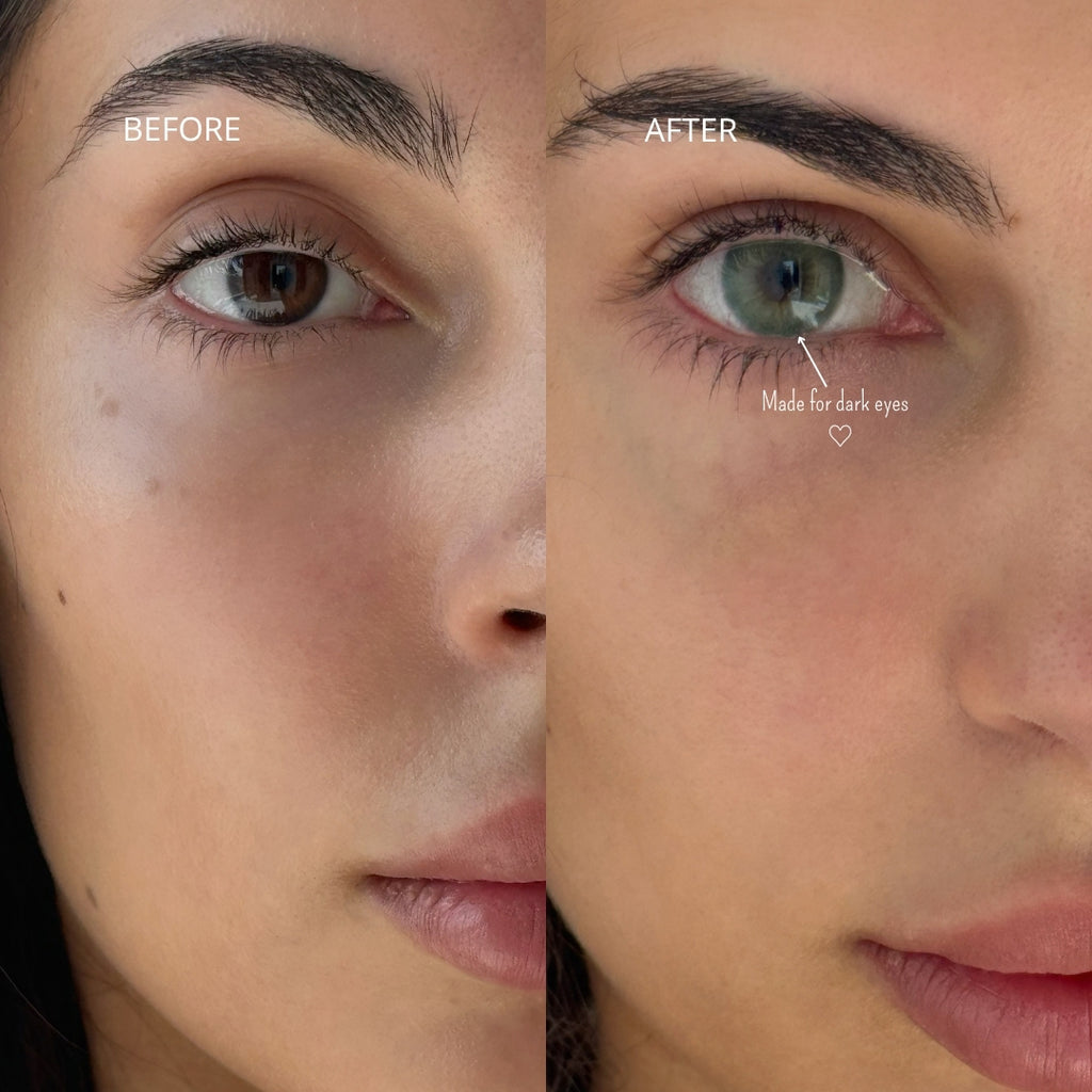 Emerald - 6 months